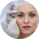 facial thread lift